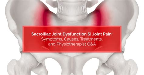 symptoms of sacroiliac joint dysfunction